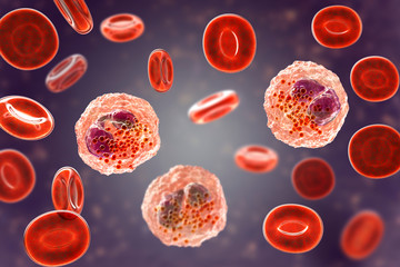 Eosinophilia, blood smear showing multiple eosinophils surround by red blood cells, 3D illustration. Eosinophilia occurs in parasitic and fungal infections, allergies, autoimmune disorders, tumors