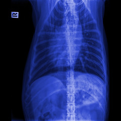 X-ray of dog anterior view closed up in thorax standard and chest with signs of pneumonia- veterinary medicine and Veterinary anatomy Concept- Blue tone color