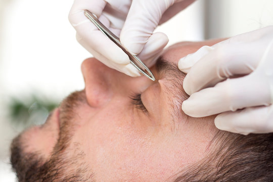 Kosmetyczka depiluje zbędne włosy na brwiach mężczyzny.