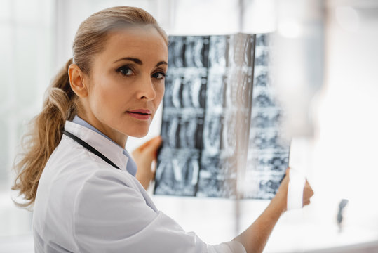 Portrait of beautiful young lady in white lab coat analyzing radiography results. She is looking at camera with serious expression