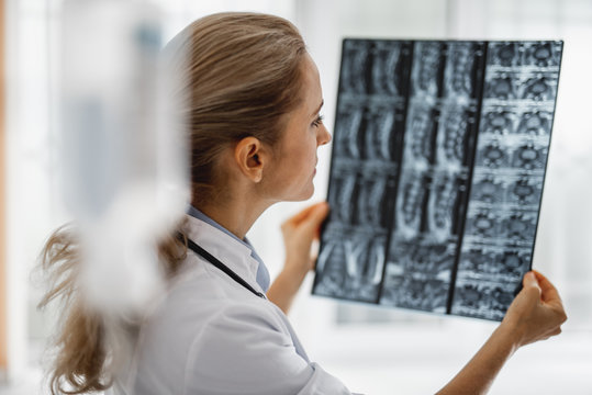Side view portrait of young lady in white lab coat looking at radiography results. Focus on woman