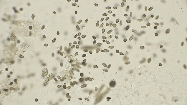 the accelerated movement of a large colony of ciliates of the ciliates, which are largely in dirty water under a microscope