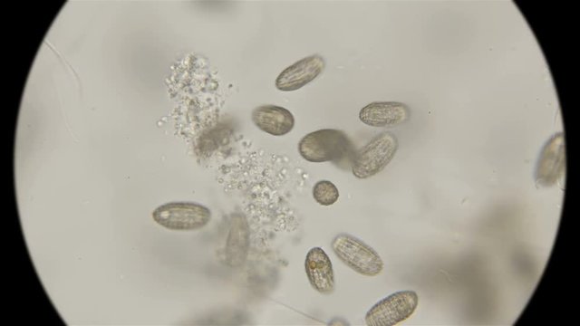 a large colony of ciliates Coleps, which are largely located in dirty water under a microscope
