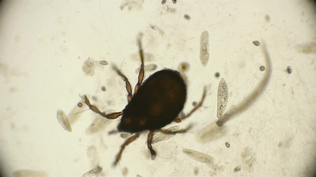 Arthropoda mite Arachnida living in reservoirs, as well as in the soil, under a microscope