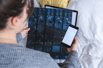 woman looking of magnetic resonance imaging result and holding phone with white screen