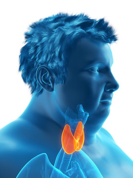 3d rendered medically accurate illustration of an obese mans thyroid gland
