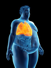 3d rendered medically accurate illustration of an obese mans lungs