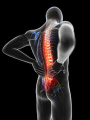 3d rendered illustration of a man having backache