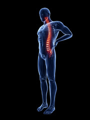 3d rendered illustration of a man having backache