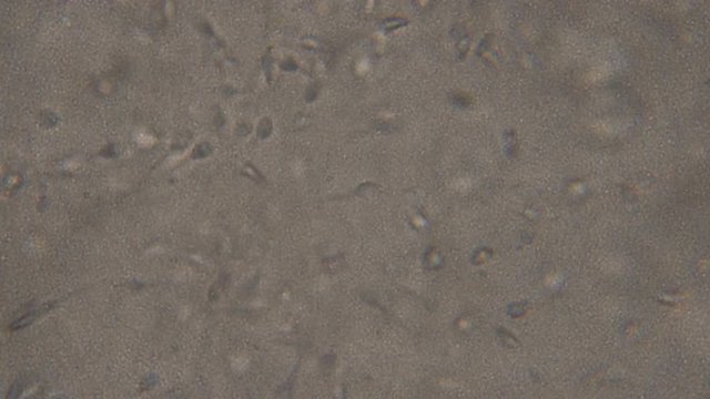 Sperm (spermatozoa) viewed under the microscope. Moving human sperm under Phase contrast Microscope, medium magnification,