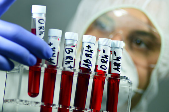 Blood laboratory tests