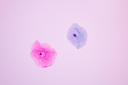 Normal squamous epithelial cells of cervical woman on white background view in microscopy.Superficial and intermediate epithelium cells.Cytology criteria from pap smear.Medical background concept.
