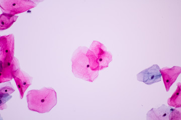 Obraz na płótnie Canvas Normal squamous epithelial cells of cervical woman on white background view in microscopy.Superficial and intermediate epithelium cells.Cytology criteria from pap smear.Medical background concept.