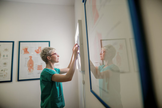 Doctor scrutinize x-ray of patient’s broken bones.