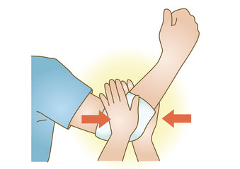 応急手当イラスト24：止血・直接圧迫止血法