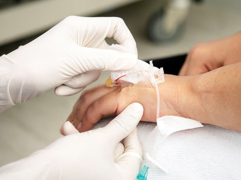 Nurse Hands Using Medical Adhesive Plaster Stick And Pull  IV Catheter On Patient Hand For Remove The Saline Needle