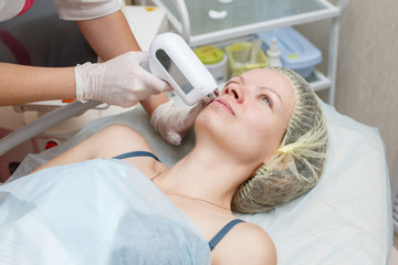 Obraz na płótnie Canvas Laser epilation treatment. Upper lip hair removal