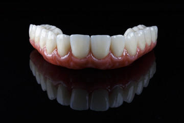 mandibular prosthesis with an imitation of natural gums, stylishly filmed on the black glass with reflection