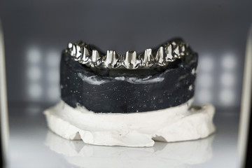 High-quality titanium bar for Dental crowns on the jaw model, photographed in the studio