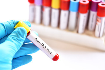 Fototapeta premium Blood sample tube for anti-TPO or anti-thyroid peroxidase test, diagnosis for thyroid hormone disease