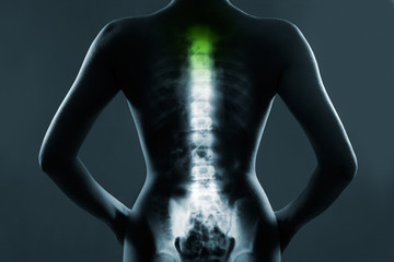 Human spine in x-ray, on gray background. The neck spine is highlighted by green colour.