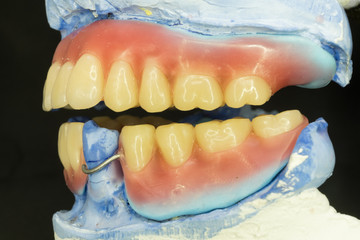 artificial teeth arrangement of removable denture