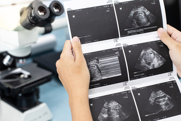 Ultrasound of baby in pregnant woman, Doctor reading test results of pregnant woman by ultrasound.