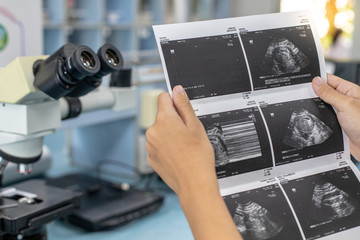 Ultrasound of baby in pregnant woman, Doctor reading test results of pregnant woman by ultrasound.