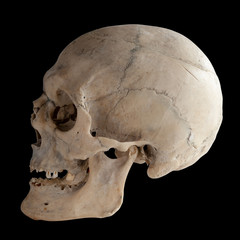 Human skull, side view. I
