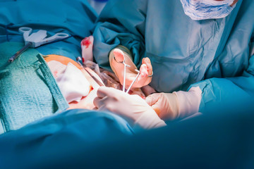 Opération chirurgicale avec ciseau