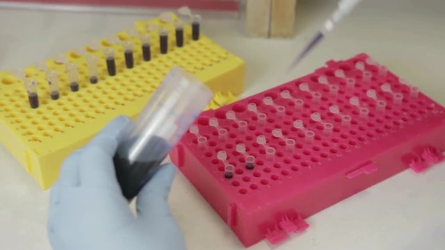 A handheld shot of a researcher pipetting samples to smaller vials in a genetic laboratory at university 
