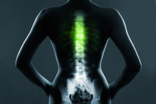 Human spine in x-ray, on gray background. The chest spine is highlighted by green colour.