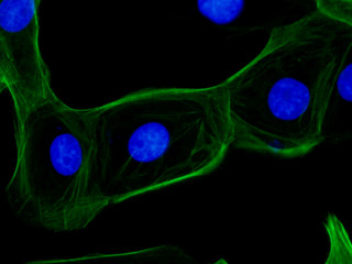 Fluorescent stem cells under the microscope