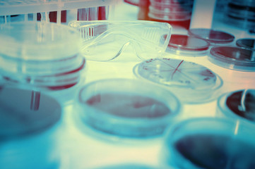 Petri dishes in the bacteriological laboratory