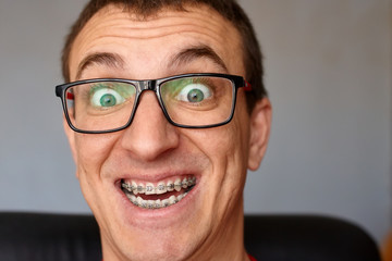 Curved teeth of guy with braces in glasses close up. Portrait of man. Crazy face. Happy expression