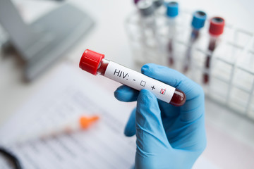 Fototapeta premium Diagnostician holding in hand a positive HIV test.