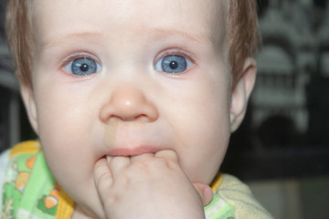 A little girl bites her fingers instead of a teether, she has snot running from her nostrils.