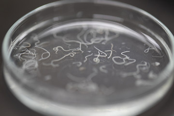 Ascariasis is a disease caused by the parasitic roundworm Ascaris lumbricoides for education in laboratories.