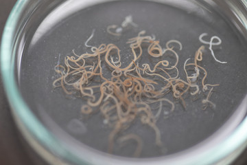 Ascariasis is a disease caused by the parasitic roundworm Ascaris lumbricoides for education in laboratories.