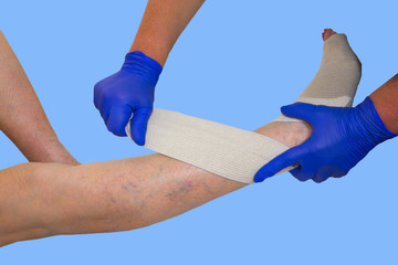 Legs. Varicose veins. Phlebeurysm. Thrombophlebitis Elastic bandage at studio