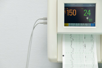 Monitor for measuring contractions, heartbeat of a pregnant woman