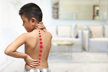 Asian kid with scoliosis