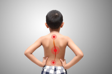 Asian kid with scoliosis, isolated on white background - obrazy, fototapety, plakaty