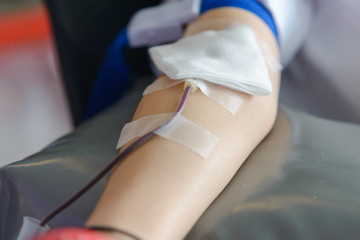 Close up right arm of asian male receiving blood and holding rubber ball in hand. Healthcare and charity. Transfusion blood donation. World blood donor day