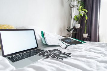 x-ray ultrasonography laptop with white screen on the bed. healthcare concept