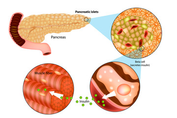 Illustration of insulin production in the pancreas. Metabolic actions of insulin in striated muscle.