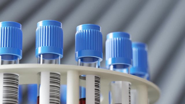 Blood samples in a test-tube centrifuge. Lab environment. Looping animation 4KHD
