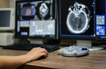 Radiotechnologist hand holding mouse while working on CT scan workstation, CT brain image is...