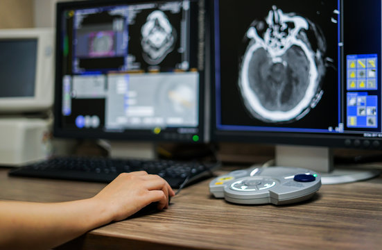 Radiotechnologist hand holding mouse while working on CT scan workstation, CT brain image is background