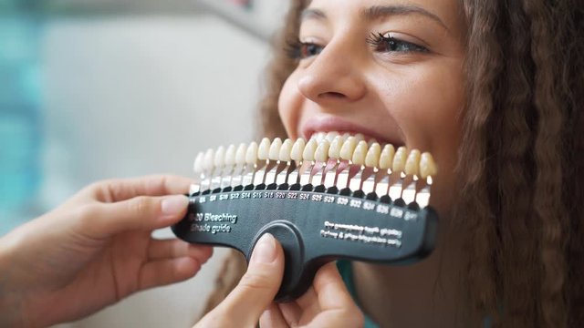 Professional cosmetic teeth whitening.